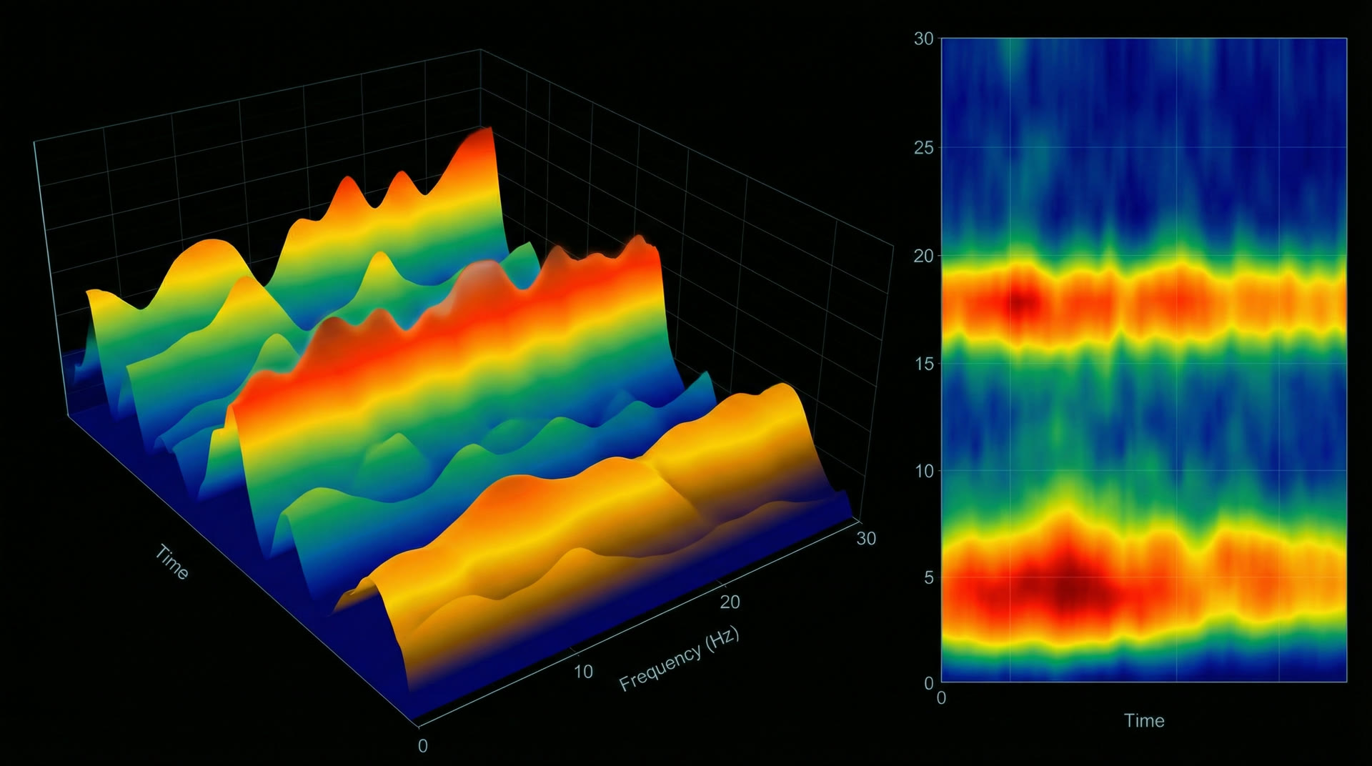 Compressed Spectral Array — brain function monitor display during anesthesia