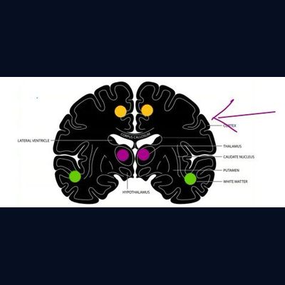 Coronal View — Brain Cross-Section