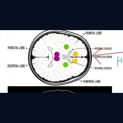 Horizontal View — Brain Axial Section