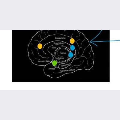 Mid-Sagittal View — Brain Medial Section