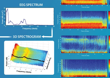 EEG spectrum and 3D spectrogram brainwave visualization